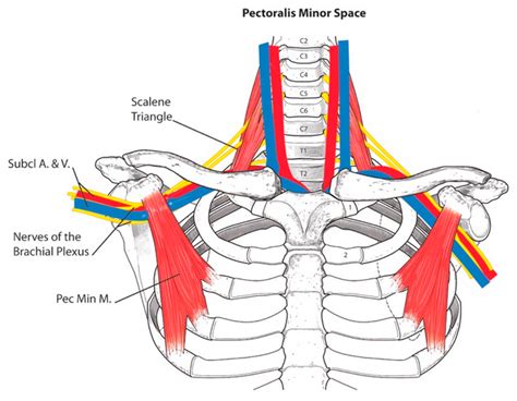 pectoralis minor tear test|brachial plexus pectoralis minor.